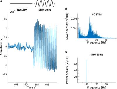 Removal of the Sinusoidal Transorbital Alternating Current Stimulation Artifact From Simultaneous EEG Recordings: Effects of Simple Moving Average Parameters
